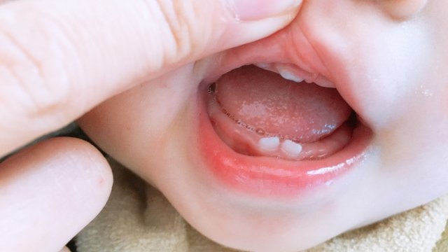 不到3歲驚見「雪崩式蛀牙」！戒除兩大傷牙壞習慣與嬰幼兒高效潔牙四步驟
